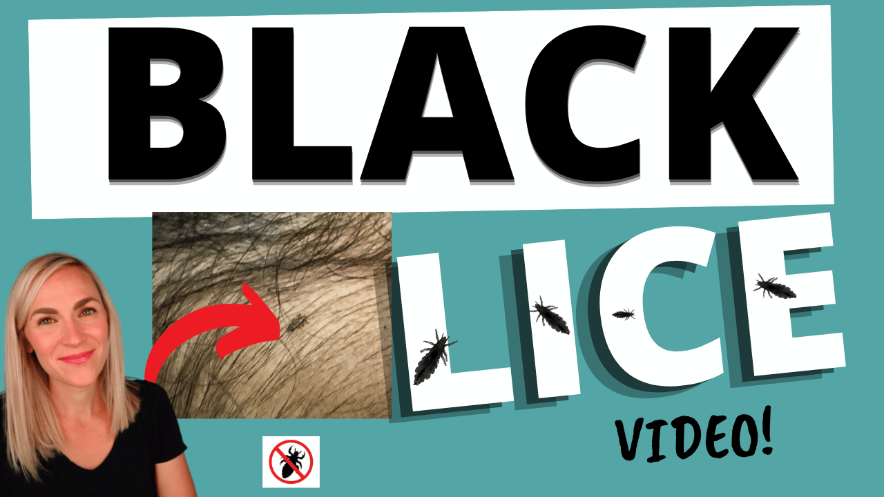 Black Lice Thumbnail Website