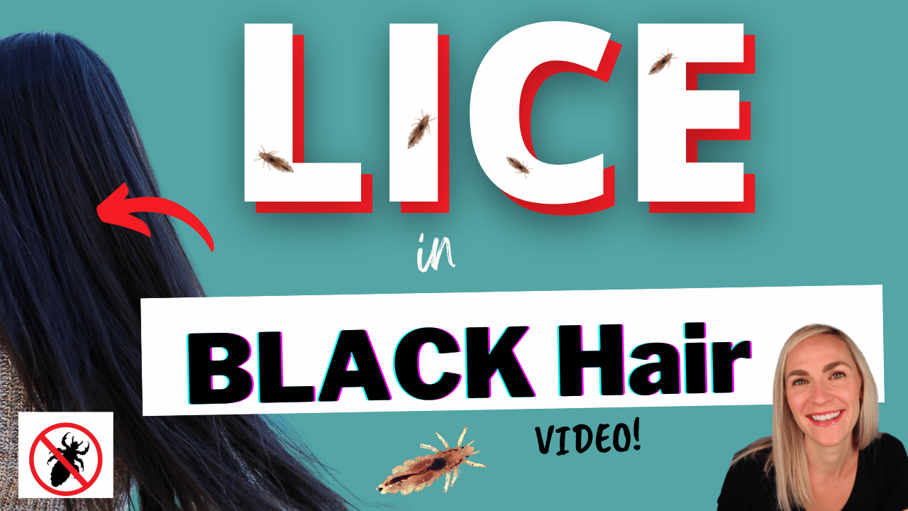 Lice in Black Hair Thumbnail 1