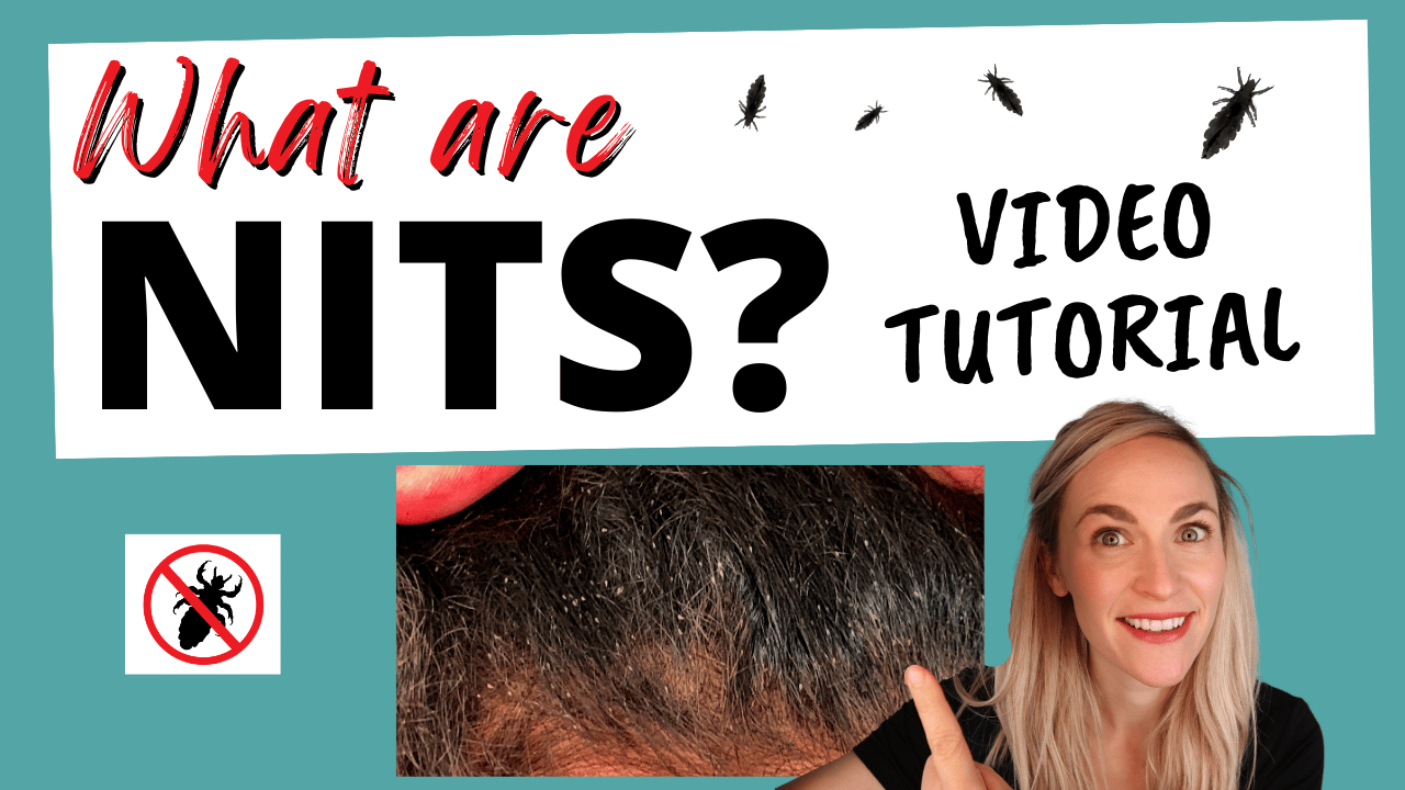 What are Nits Thumbnail