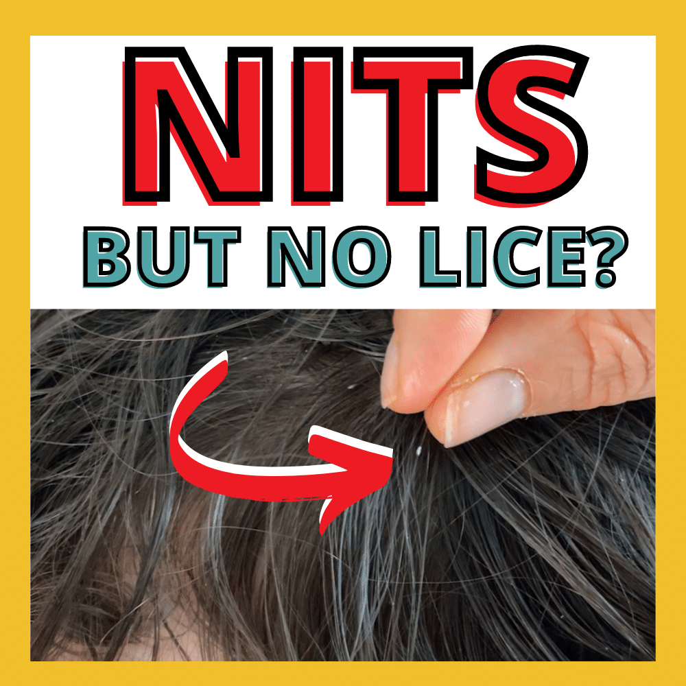 nit in hair without any lice bugs